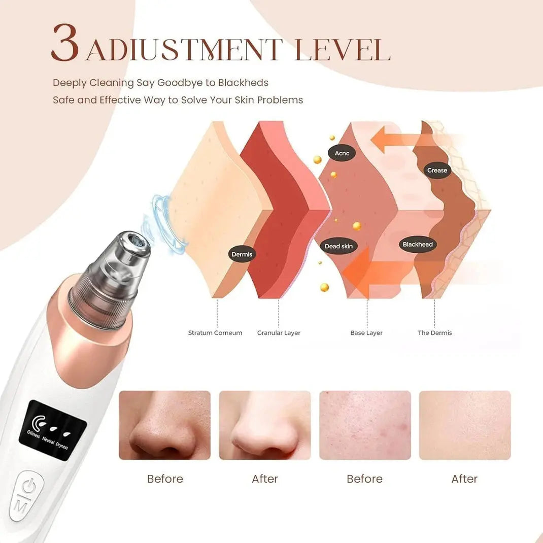 5-in-1 Electric Blackhead Remover & Pore Vacuum Scrollcart Qatar 