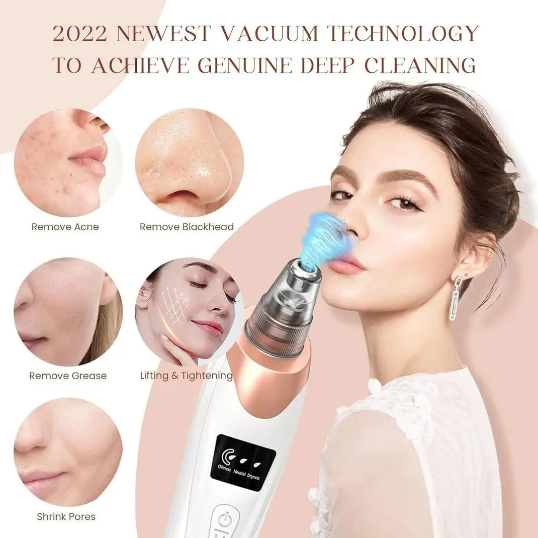 5-in-1 Electric Blackhead Remover & Pore Vacuum Scrollcart Qatar 