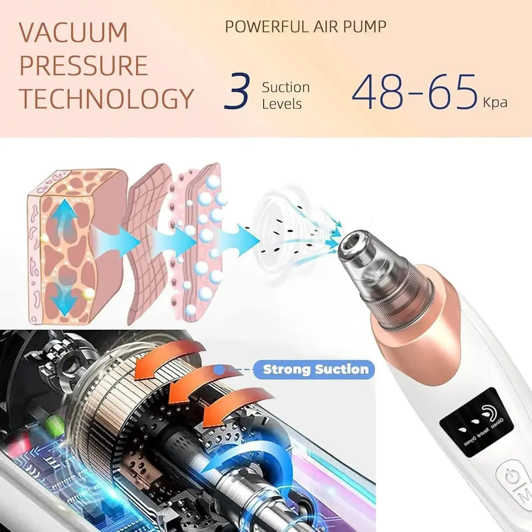 5-in-1 Electric Blackhead Remover & Pore Vacuum Scrollcart Qatar 
