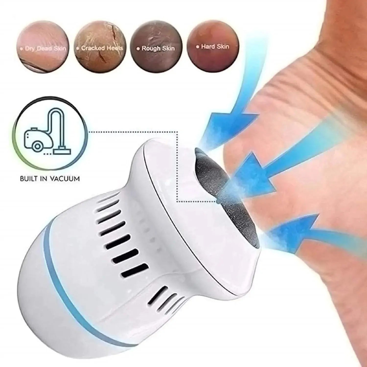Electric Foot Grinder Vacuum Callus Remover – Rechargeable Pedicure Foot File with Dust Suction & USB Charging Scrollcart Qatar 