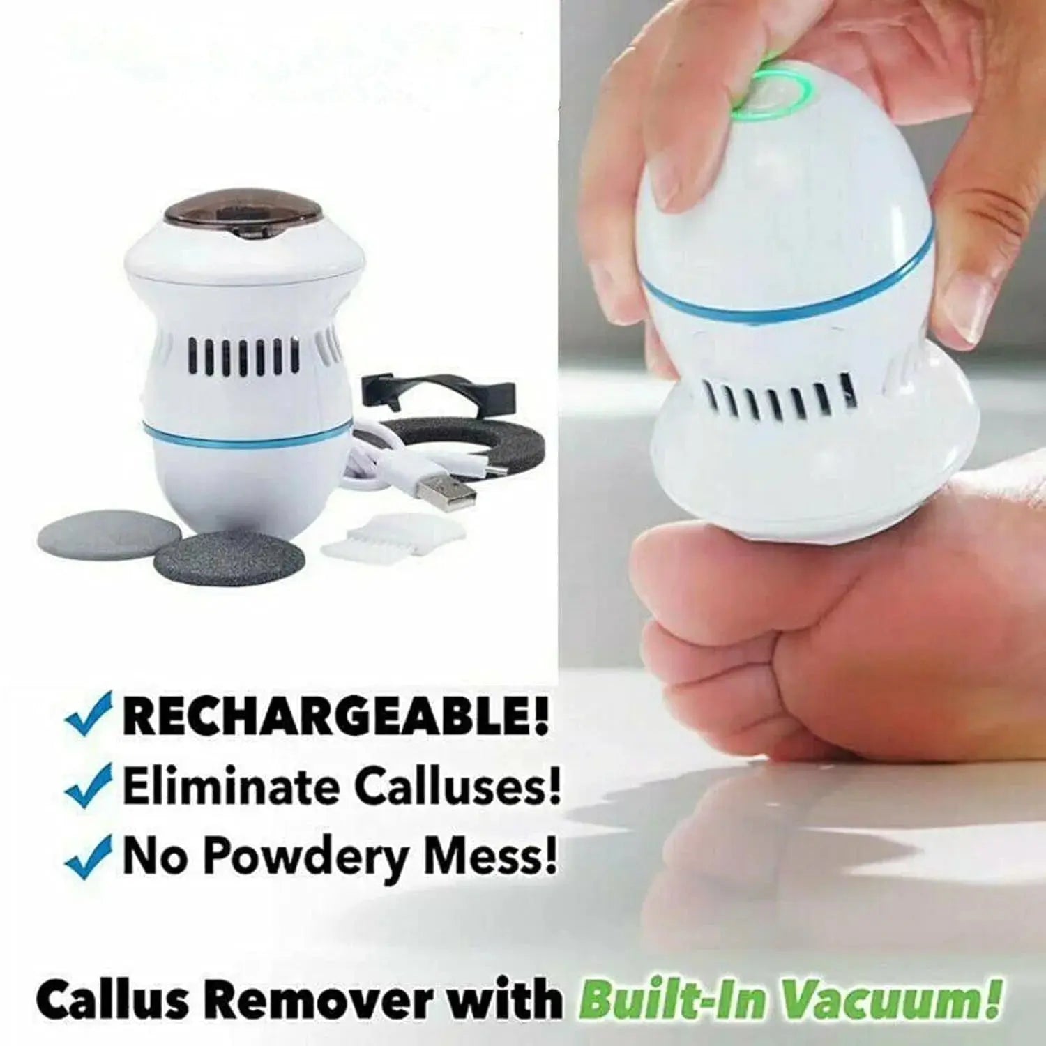 Electric Foot Grinder Vacuum Callus Remover – Rechargeable Pedicure Foot File with Dust Suction & USB Charging Scrollcart Qatar 