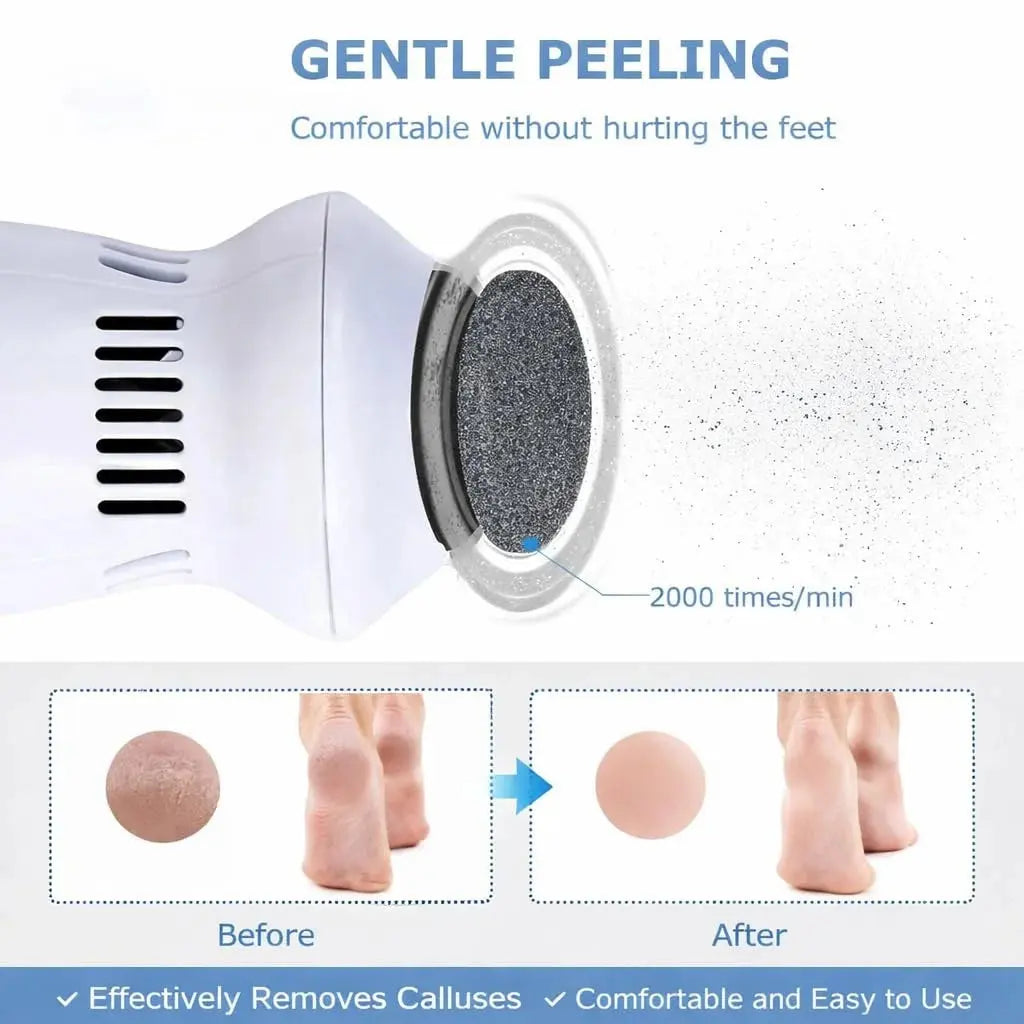 Electric Foot Grinder Vacuum Callus Remover – Rechargeable Pedicure Foot File with Dust Suction & USB Charging Scrollcart Qatar 